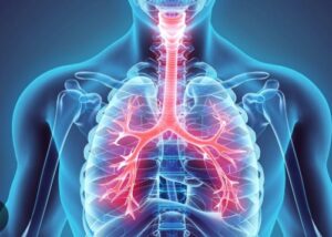 respiratory disease